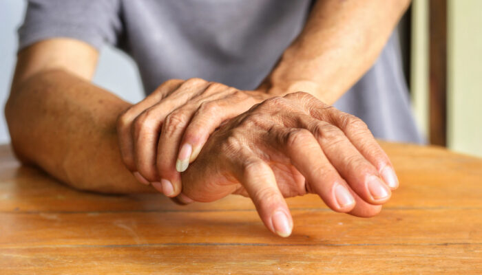 Ways To Manage Psoriatic Arthritis With Lifestyle Changes